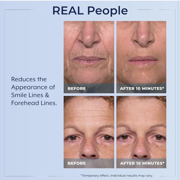 2 Plexaderm Rapid Reduction Advanced Serum AS SEEN ON TV's Best Selling Skincare - Picture 11 of 15